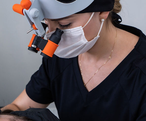 Tecnologia a favor do transplante capilar