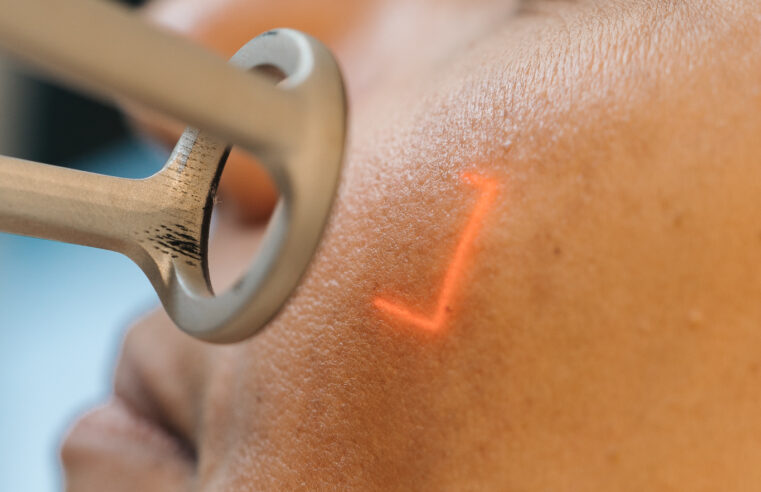 Por que todo mundo precisa cuidar da pele no inverno?