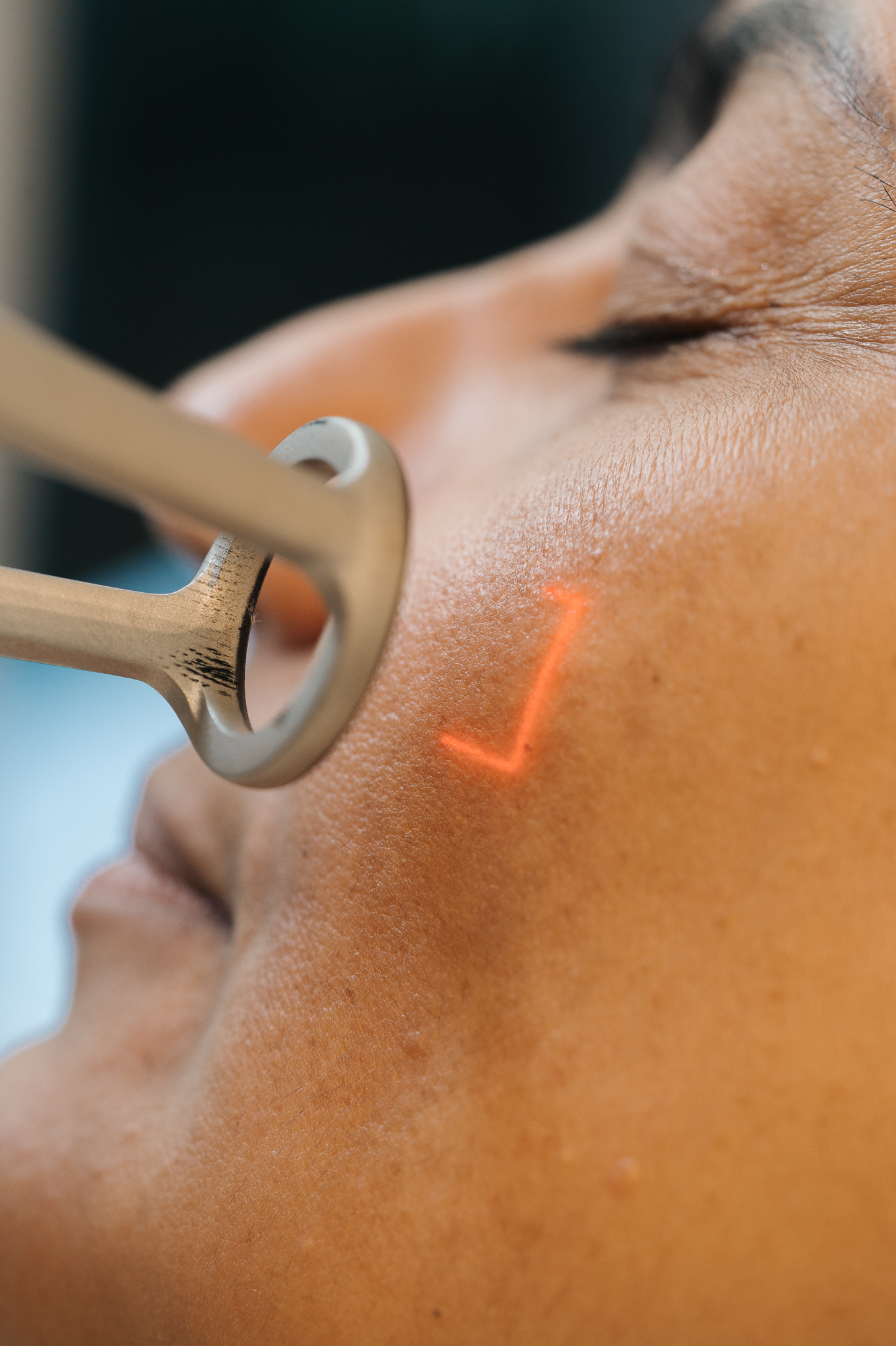 Por que todo mundo precisa cuidar da pele no inverno?