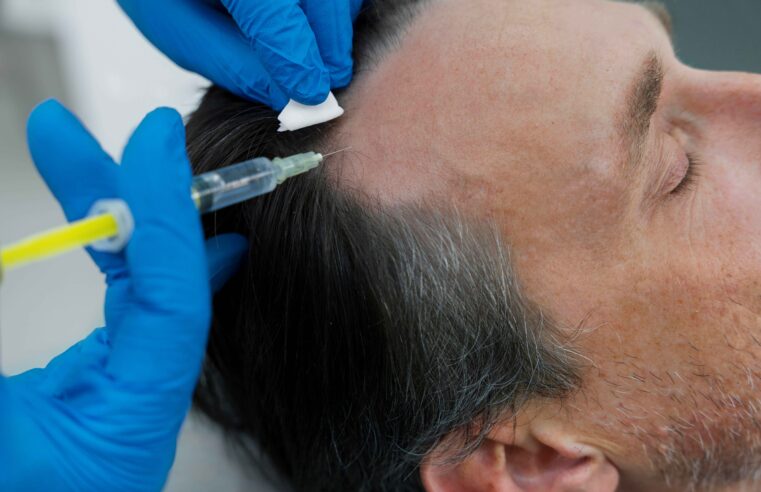 Cuidado capilar masculino ganha espaço nos consultórios dermatológicos