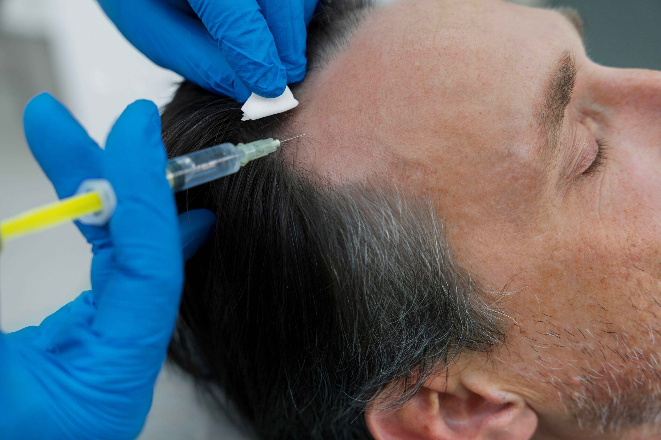 Cuidado capilar masculino ganha espaço nos consultórios dermatológicos